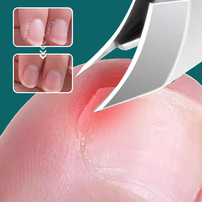 Anti-slask snedkant nagelklippare 3-stycke uppsättning