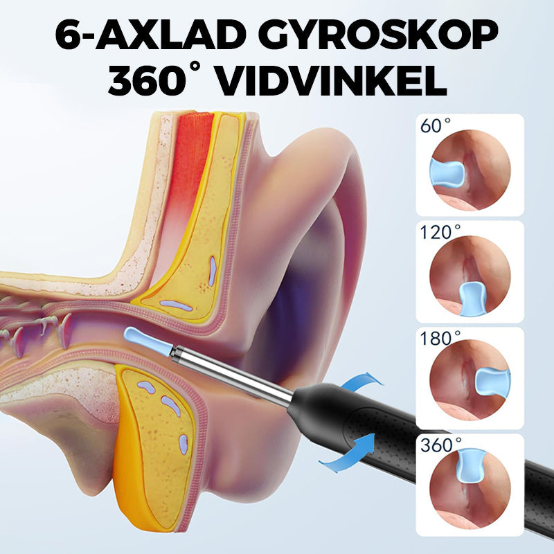 Visuell Elektriskt Verktyg för Öronvax Borttagning