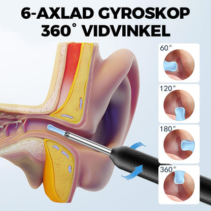 Visuell Elektriskt Verktyg för Öronvax Borttagning