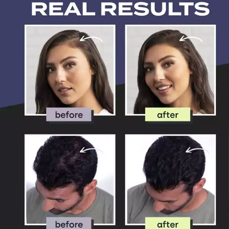 🔥 50% RABATT NU! 💇‍♂️ Hårbyggande fiberset – omedelbar volym, naturligt utseende & vattentätt skydd – perfekt för tunnhårighet och fläckar ✨