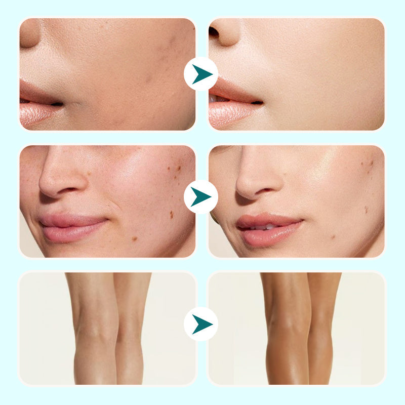 🔥40 % rabatt så länge lagret räcker!🎉Återfuktande Concealer Vattenfast Kräm för Kvinnor - 12H Långvarig Täckning