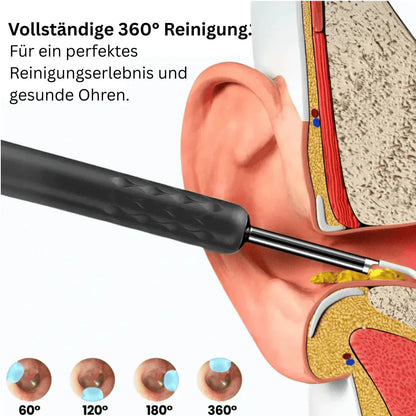 Sverigeify®💥Intelligent vattentät visuell öronvaxborttagare