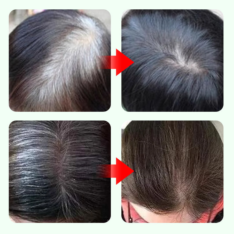 ✏️ KÖP 2 FÅ 3! ✨ 3-färgs Hårpenna för Grått Täckning - 10-sekunders Återställning med Vattenfast Formel för Omedelbar Ungdomlig Look 🌟🧴