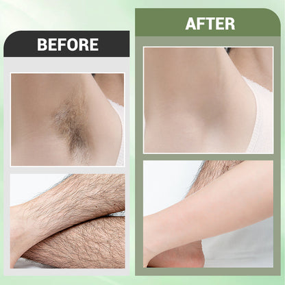 KÖP 2 FÅ 1 GRATIS 🤩 Hårborttagningskrämkit för kvinnor 🤩