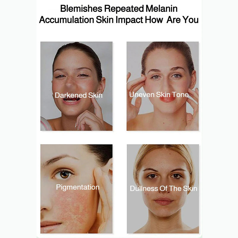 🔥Strålande hudblekning  &  Fläckkorrigerande spray