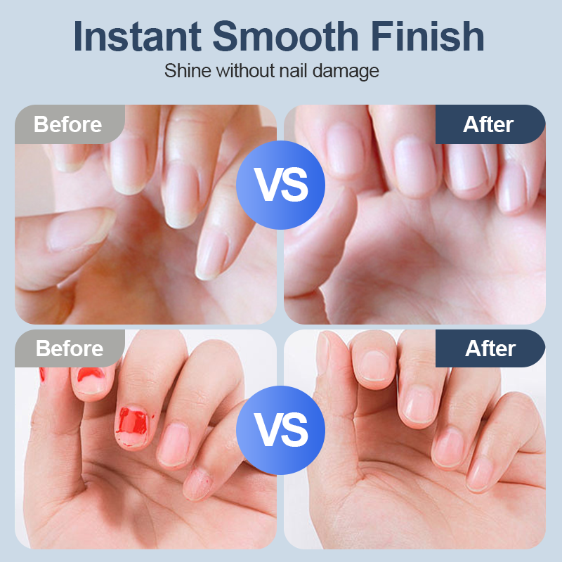 💅 KÖP 3 FÅ 1 GRATIS! 🔥 Universal automatisk nagelfil – 6 hastighetsinställningar med 5 tillbehör för säker och skonsam nagelvård 👶🔧