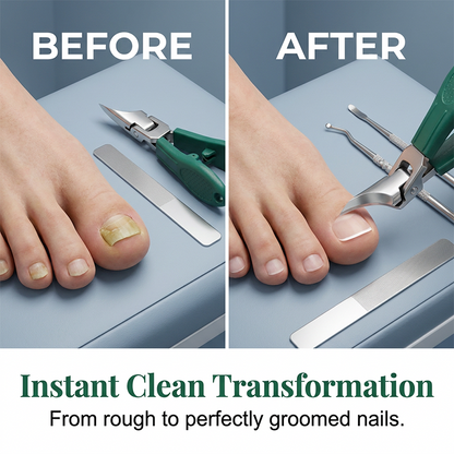 ✂️ Tre-delat set för precis nagelvård | Böjt blad som förhindrar sprickor – dubbelsidig fil för att jämna ut ojämnheter | 🏃‍ Hemvård – perfekt att ta med på resan