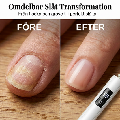 ✨Professionell elektrisk nagelfil——uppgradera din nagelvård med 99 hastigheter & 4 tillbehör ✨💅