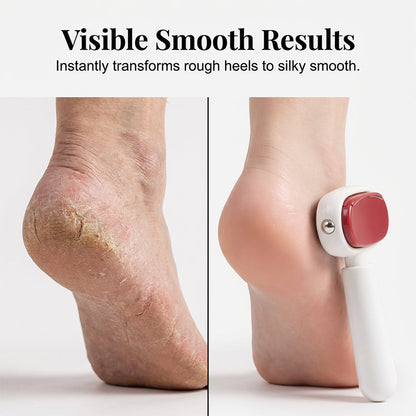 🦶💎 50 % RABATT! Förvandla torra, spruckna hälar till mjuka fötter – den dubbelsidiga filen i rostfritt stål tar bort förhårdnader på några sekunder. Både hemma och på resan!